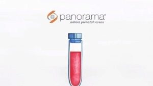 Hamilelik sırasında neden Panorama'yı test ediyorlar ve bu konudaki incelemeler neler?