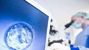 Güne göre IVF uzun protokol: şema ve açıklama
