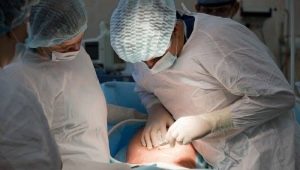 Is it possible to make a fourth cesarean section? Reviews and opinions of doctors