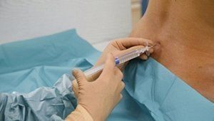 Spinal anesthesia for caesarean section