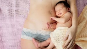 All about cicatrix after cesarean section