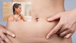 How many days after a c-section can you take a bath or shower?
