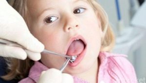 Psychosomatics ng periodontal disease sa mga matatanda at bata