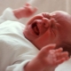Scale APGAR: pag-decode ng mga marka ng mga bagong silang sa talahanayan