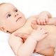 Mga sintomas at paggamot ng mga umbilical luslos sa mga bata