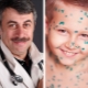 Dr. Komarovsky: o que é varicela e como tratá-la