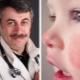 الدكتور كوماروفسكي عن الخدين الحمراء في الطفل