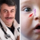 Dr Komarovsky di urut terusan lacrimal pada bayi baru lahir