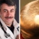 Dr Komarovsky tungkol sa mga sanhi ng pagkawala ng buhok sa mga bata