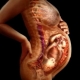 Ursachen einer dünnen Plazenta während der Schwangerschaft und die Auswirkungen von Hypoplasie