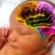 Ang organikong pinsala sa utak (encephalopathy) sa mga bata