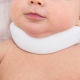 Mga palatandaan at sintomas ng torticollis sa mga bagong silang at mga sanggol