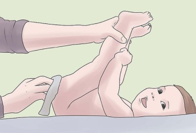 كيفية تقديم الشموع الجلسرين لحديثي الولادة