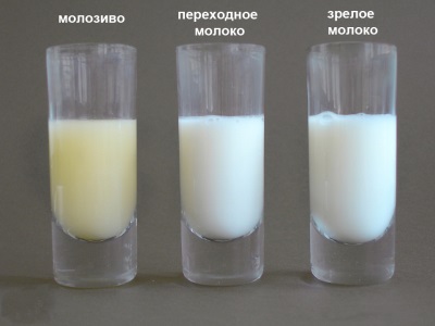 Aussehen der Muttermilch