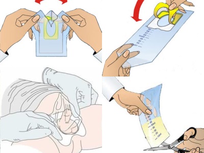Como coletar urina - urinol para meninos
