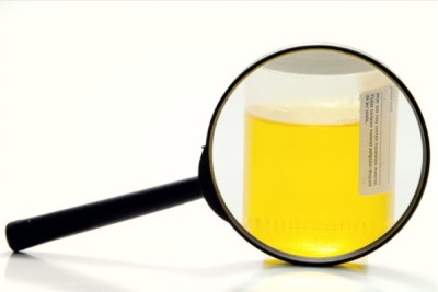 Urine turbidity test at home