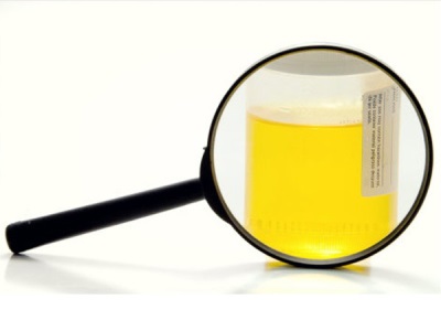 Urinanalyse
