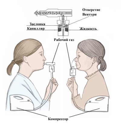 Compression nebulizer operation - scheme